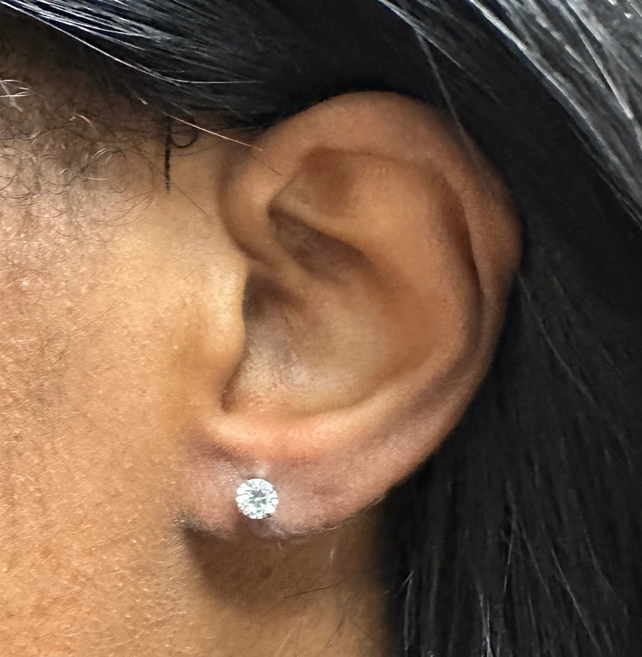 Earlobe after re-piercing with elegant earring